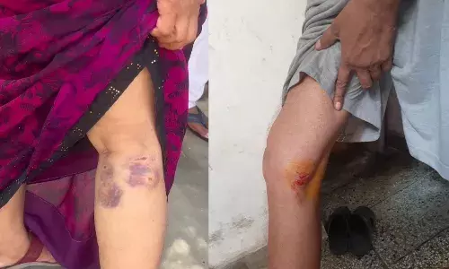 MUZAFFARNAGAR-ब्रह्मपुरी में आवारा कुत्तों का आतंक, नागरिकों में भय