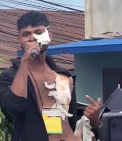 Nepal Viral Video: खून से सनी टी-शर्ट में घायल युवक ने PM ओली सरकार को दी चुनौती